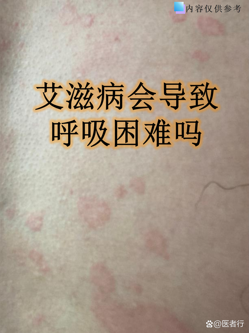 逊克县12月6日新增无症状感染者18例/今日逊克疫情关注