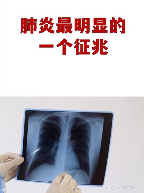 31省昨日新增28例无症状感染者/31省区市新增确诊42例 无症状38例