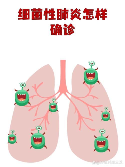 山东省济宁市任城区近期新增4例核酸阳性/济宁市任城区新冠肺炎