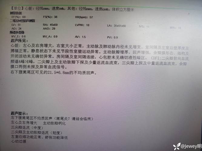 专家:安徽安庆每年或现多个感染高峰/安庆几个病例